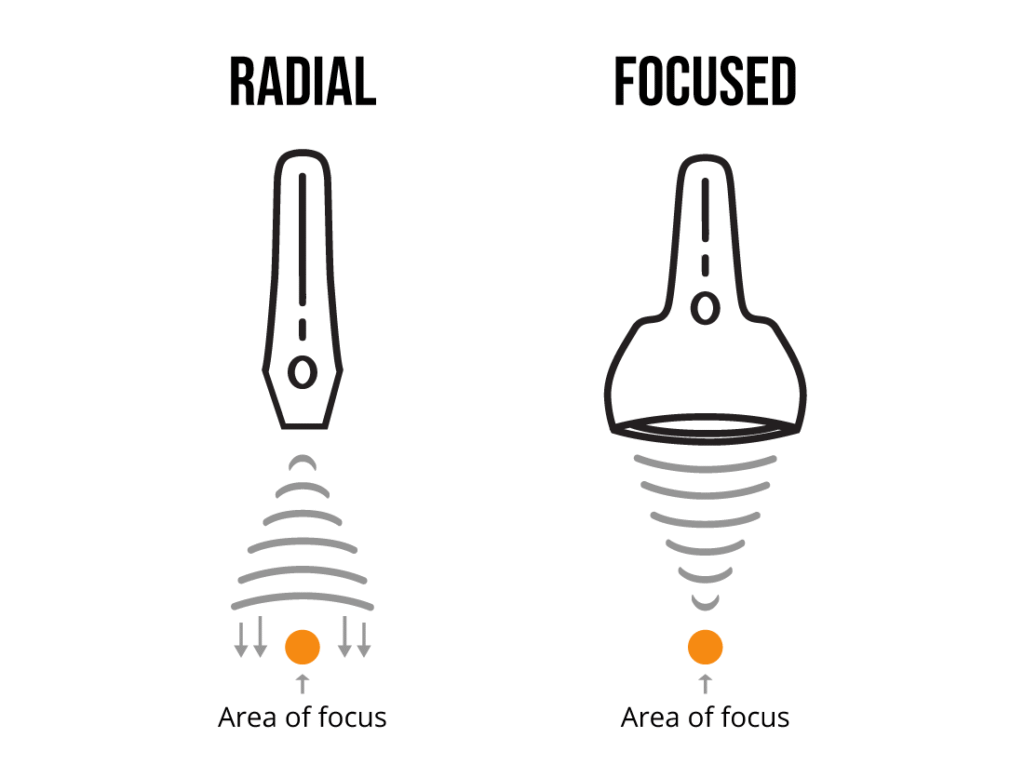 Diagram comparing radial wave vs focused acoustic wave therapy for erectile dysfunction (ED) at The Apex Lounge in St. George, Utah – showing deeper, more precise energy delivery with PiezoWave2